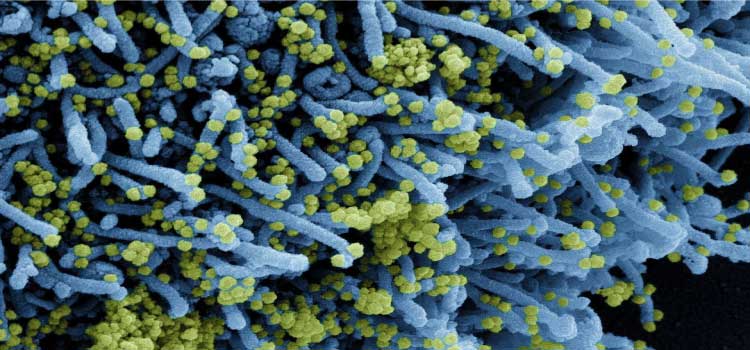  INTERNACIONAL: Descoberta nova variante do coronavírus com grande número de mutações