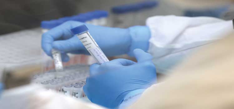  PARANÁ: saúde divulga mais 481 casos e 28 óbitos de H3N2