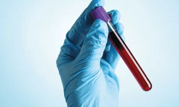 Exame de sangue pode auxiliar na investigação precoce do Alzheimer