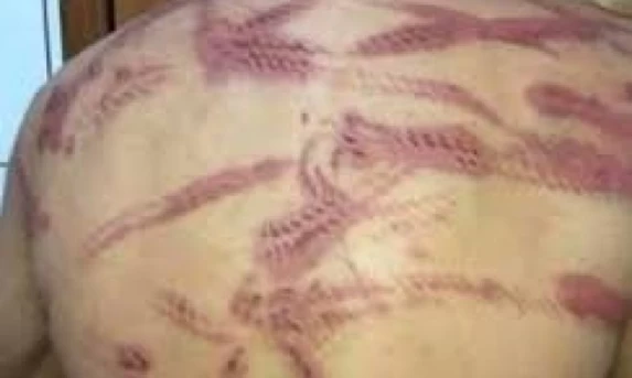 HOMEM QUE AGREDIU ESPOSA É ALVO DE RETALIAÇÃO EM CASCAVEL; CASO VIRA DESTAQUE NAS REDES