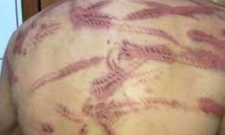 HOMEM QUE AGREDIU ESPOSA É ALVO DE RETALIAÇÃO EM CASCAVEL; CASO VIRA DESTAQUE NAS REDES