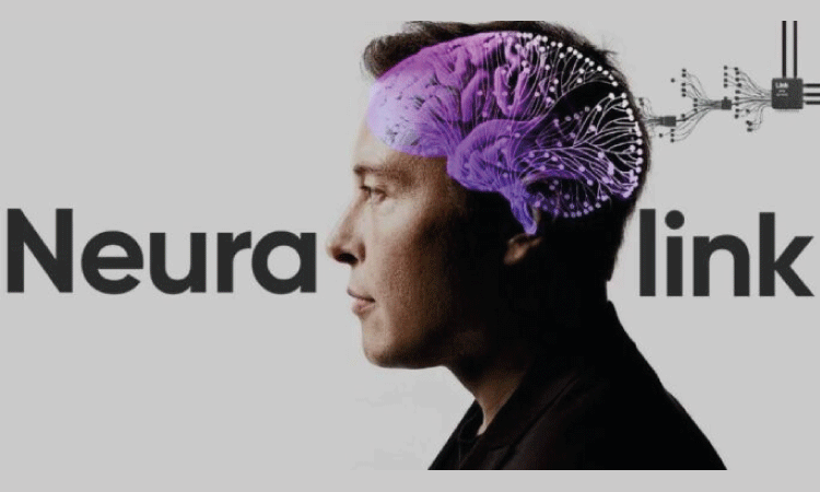 INTERNACIONAL: Empresa de Elon Musk, faz 1º implante de chip cerebral em humano.