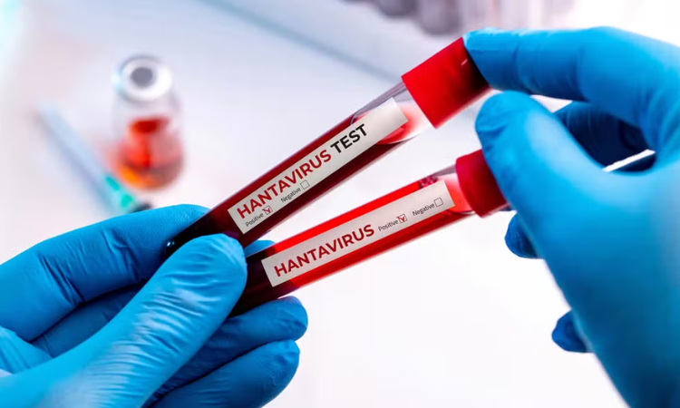 Paraná confirma dois casos de hantavírus e monitora outros 11 suspeitos