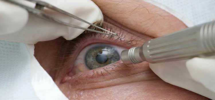 SAÚDE: Abril Marrom alerta sobre doenças que podem levar à cegueira.