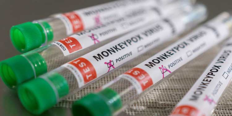 SAÚDE: Brasil já registra ao menos 16 casos de varíola dos macacos.