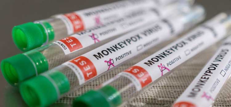 SAÚDE: Brasil recebe o primeiro lote de vacinas contra a varíola dos macacos.