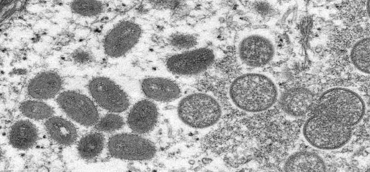 SAÚDE: Brasil tem mais de 200 casos confirmados de varíola dos macacos.