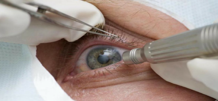 SAÚDE: Doença ocular relacionada à idade pode levar à cegueira.