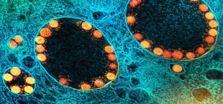 SAÚDE: França identifica nova variante do coronavírus com mais de 40 mutações