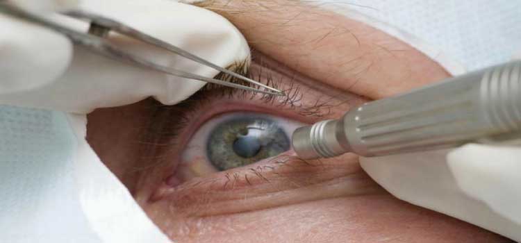 SAÚDE: Guia tenta evitar expansão de casos de cegueira por glaucoma