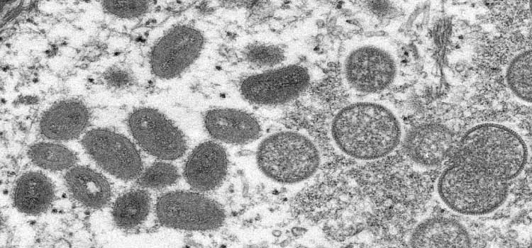 Saúde monitora sete casos suspeitos de varíola dos macacos.
