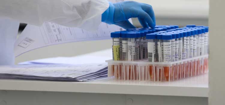 SAÚDE: Paraná confirma 113 novos casos e mais três óbitos de H3N2